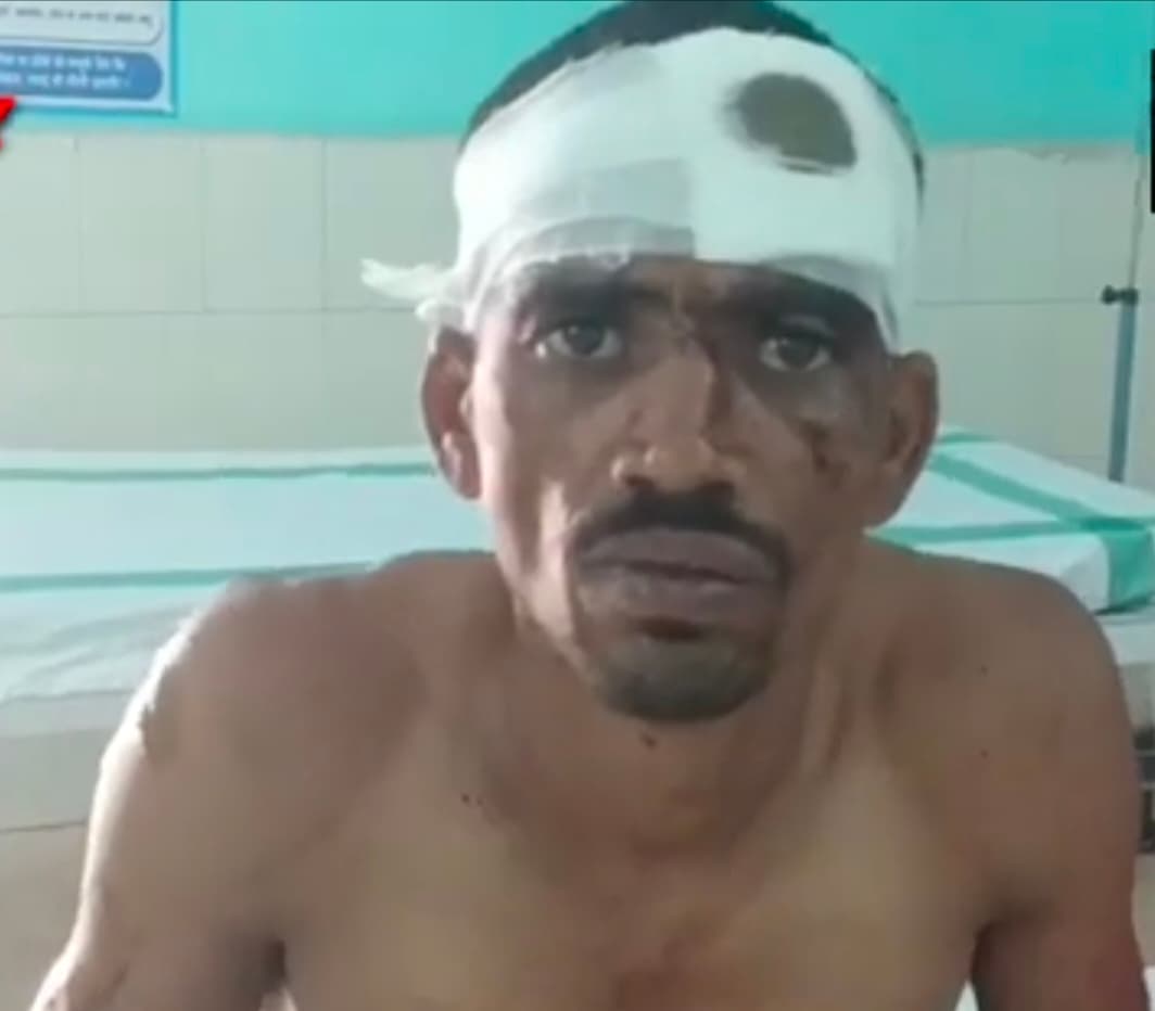 मामलू विवाद में बड़े भाई ने छोटे भाई को पीट-पीट कर किया घायल