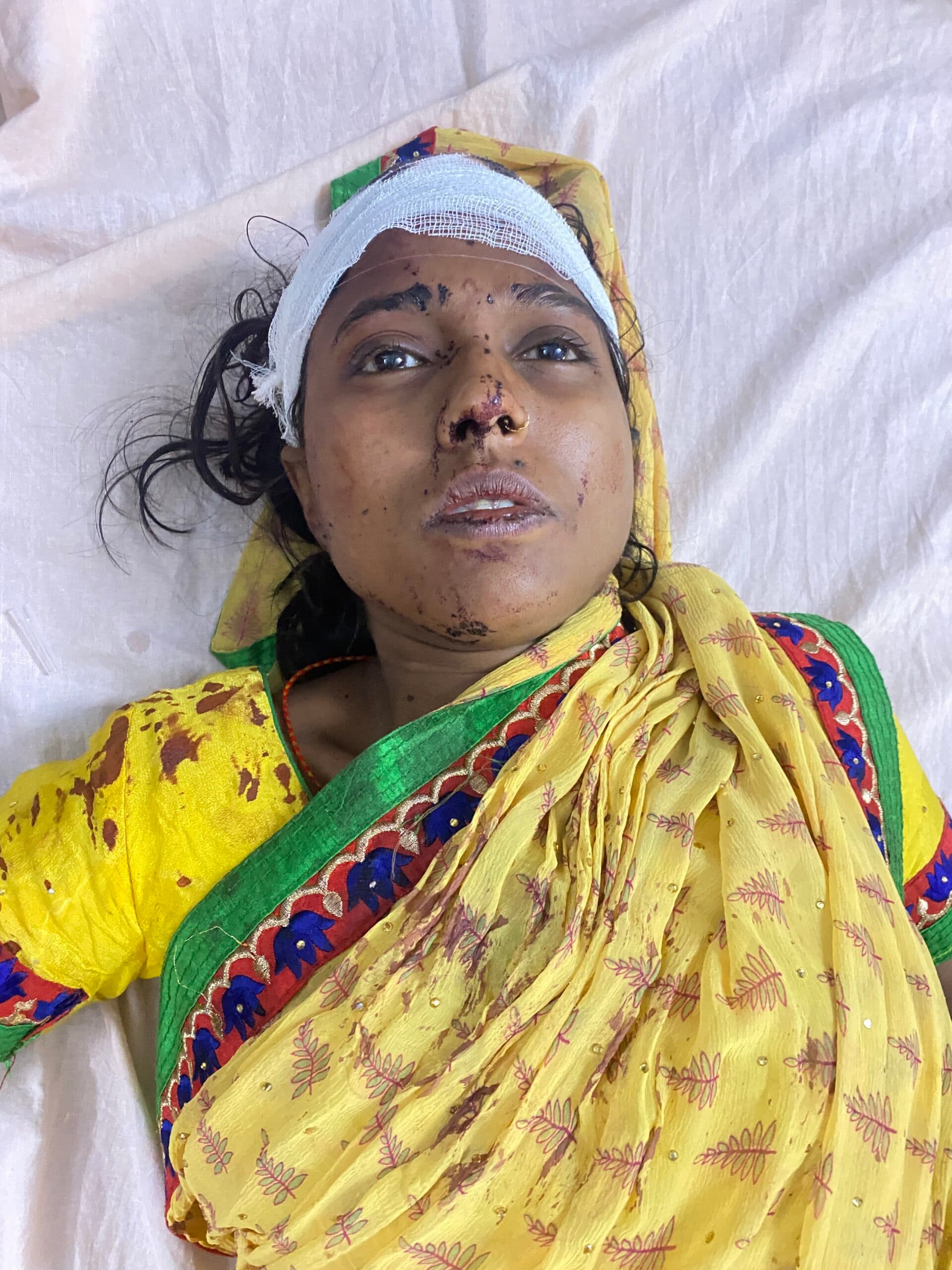 Gridih News : दहेज के लिए दो माह की गर्भवती महिला से मारपीट