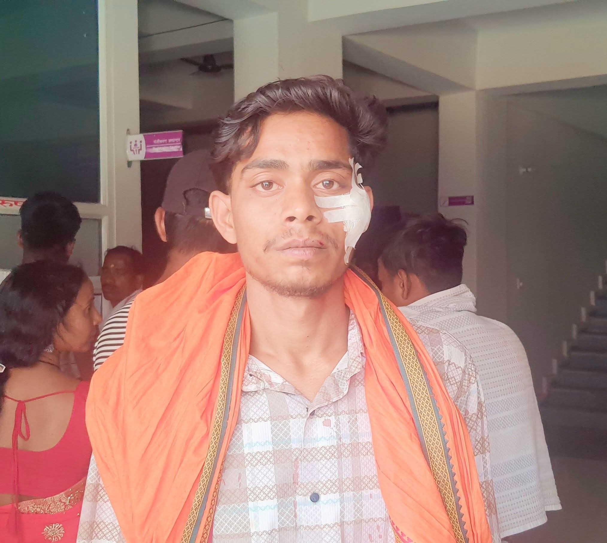 शादी समारोह में मेहमान को बेरहमी से मारपीट कर किया घायल