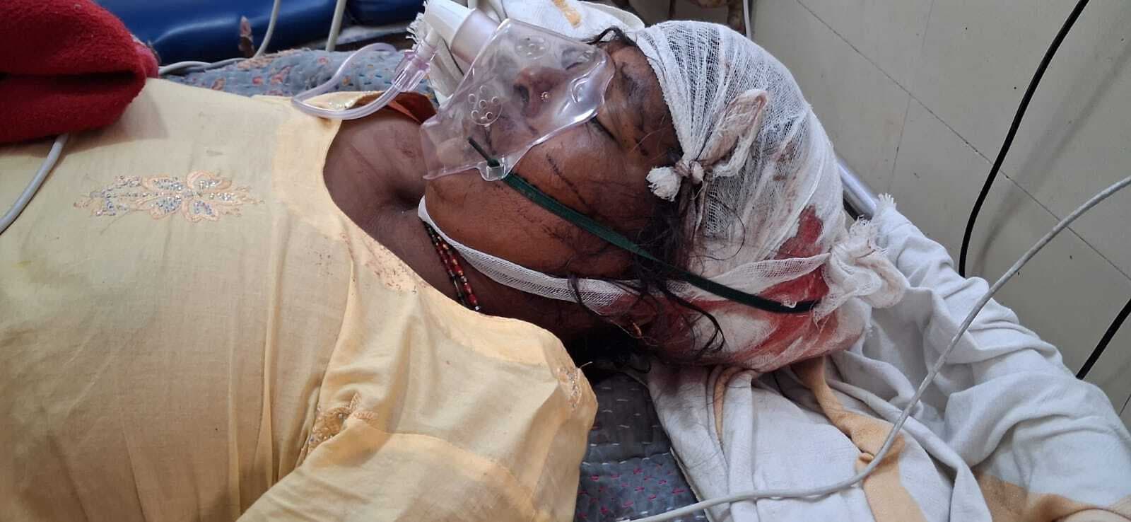 फलका के वाहिद नगर टोला में सास पर जानलेवा हमला, हालत गंभीर, पटना रेफर