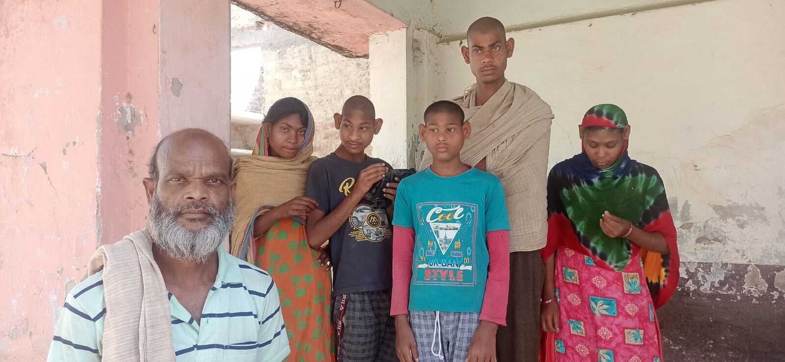 फलका में फ्लोराइड की मार, कई परिवारों का जीवन बना अभिशाप