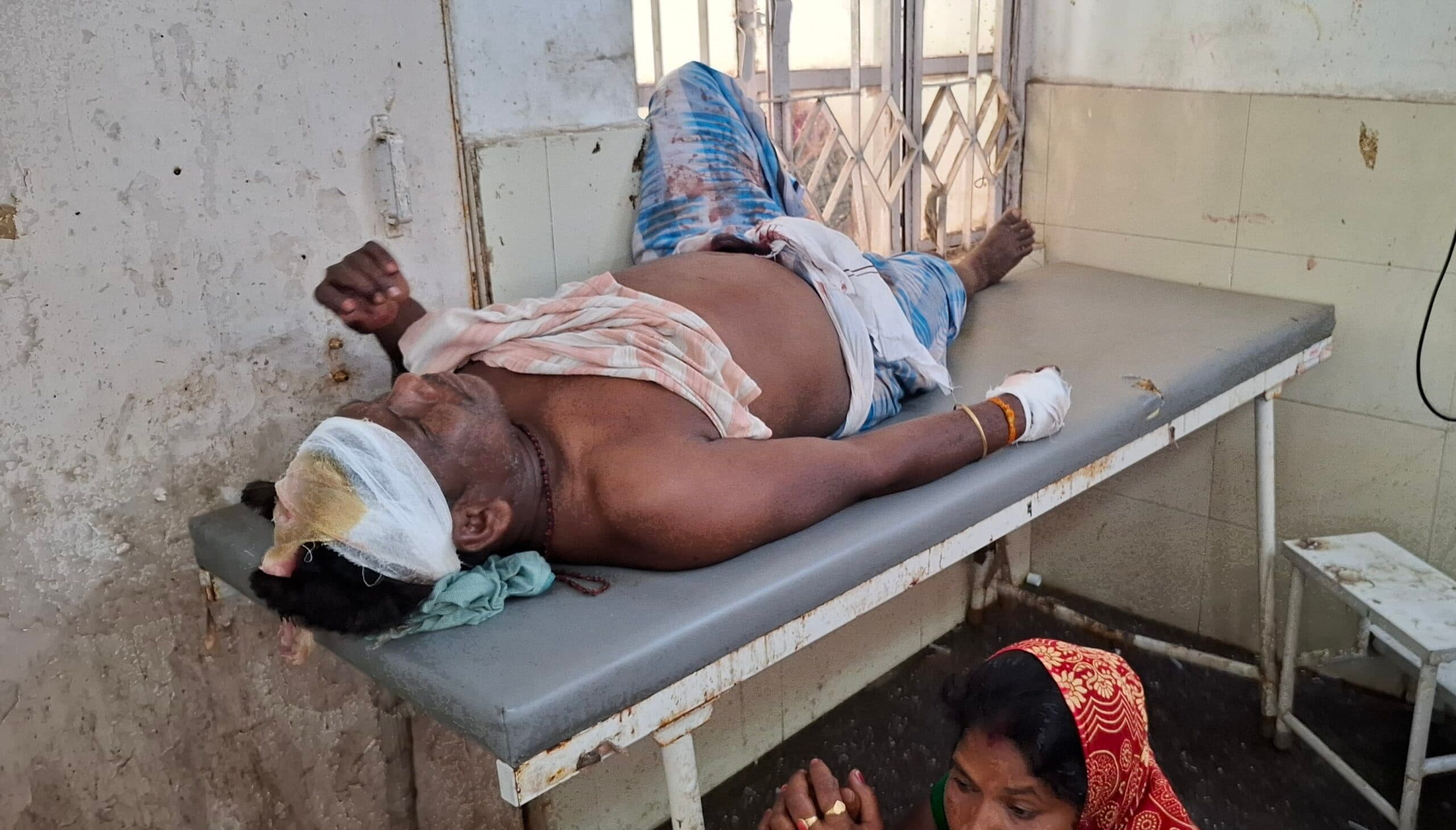 मजदूरी के पैसे मांगने पर मजदूर के सिर पर रॉड से हमला, हालत नाजुक