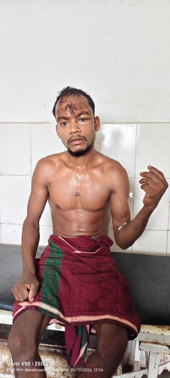 जमीन विवाद में खूनी संघर्ष, चौकीदार की कुल्हाड़ी से हत्या, बेटा गंभीर