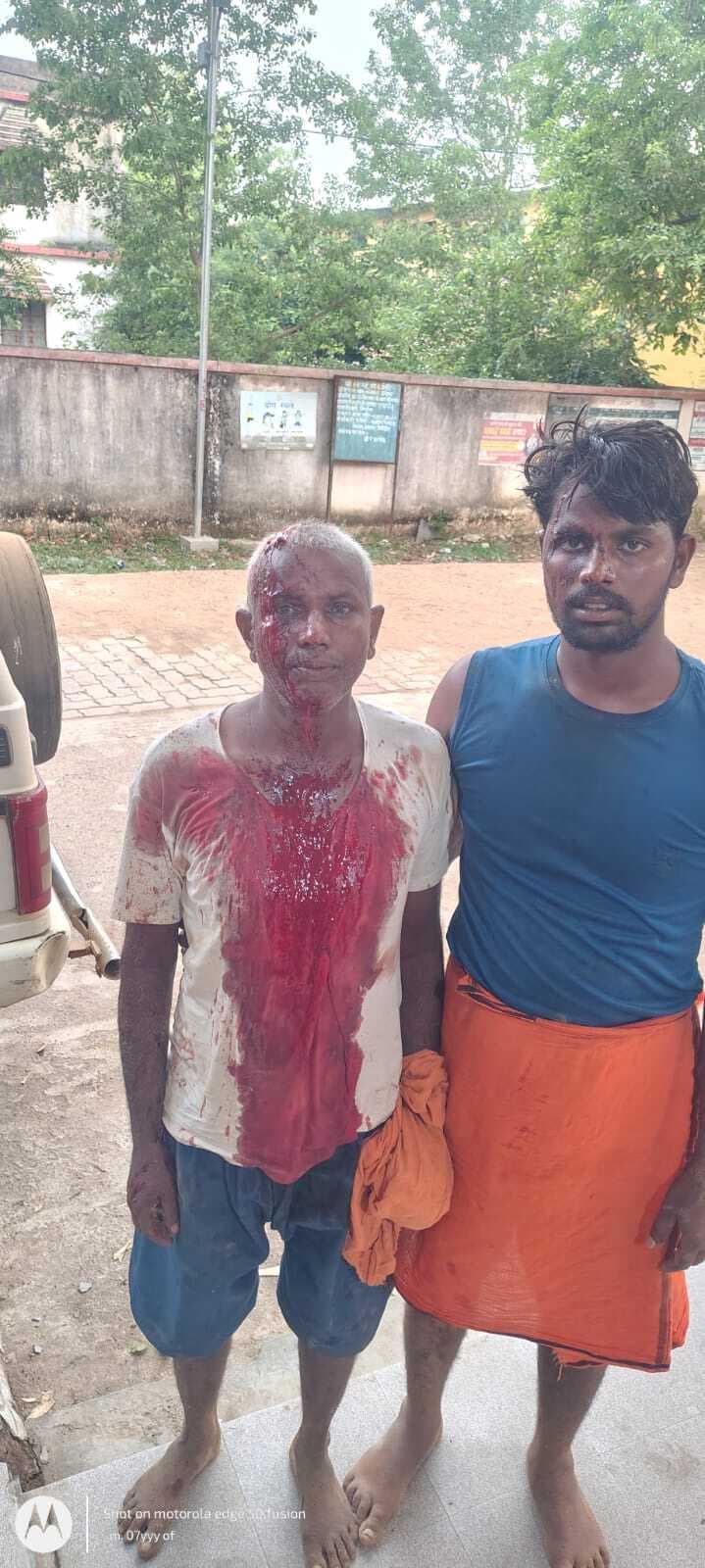 Giridih News : कुएं में गंदा पानी गिराने का विरोध करने पर मारपीट