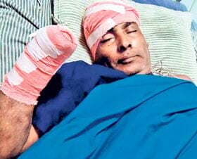 अपराधियों ने पंसस का हाथ काट डाला