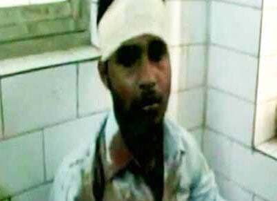 पश्चिम बंगाल:माकपा-तृणमूल समर्थकों के बीच संघर्ष,13 घायल