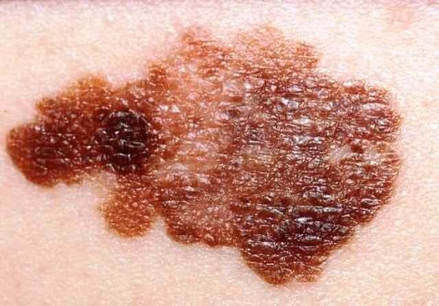 एंटीऑक्सीडेंट भी हो सकता है खतरनाक!