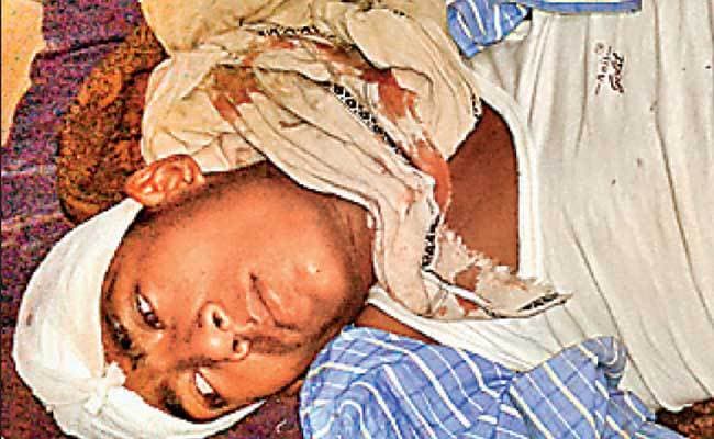 विस्फोट में छह बच्चे घायल