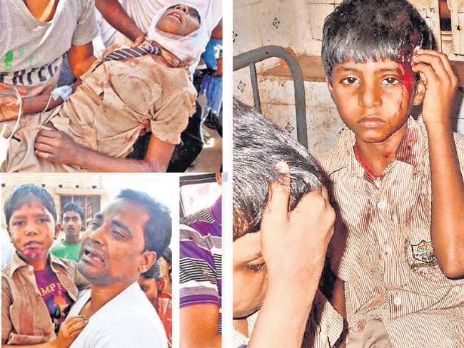 पेड़ से टकरायी स्कूल बस, 60 बच्चे घायल