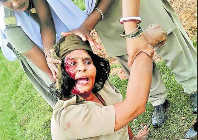 बड़कागांव में रैयतों व पुलिस में झड़प, फायरिंग, वाहन जलाये