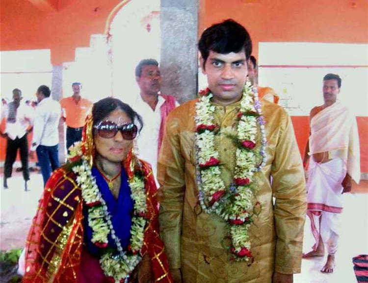 तेजाब पीड़िता सोनाली मुखर्जी 100 वुमेन एचिवर्स में शामिल, राष्ट्रपति के भोज में होंगी शामिल