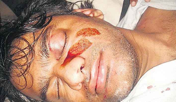 PMCH : डॉक्टर ने बाहरी गुंडों को बुला कर डॉक्टर को ही पिटवाया