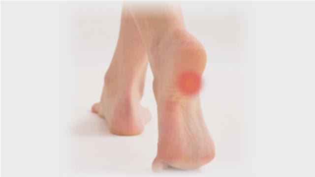 लगातार सूजन और दर्द आपके पैरों को दे सकता है गंभीर बीमारी