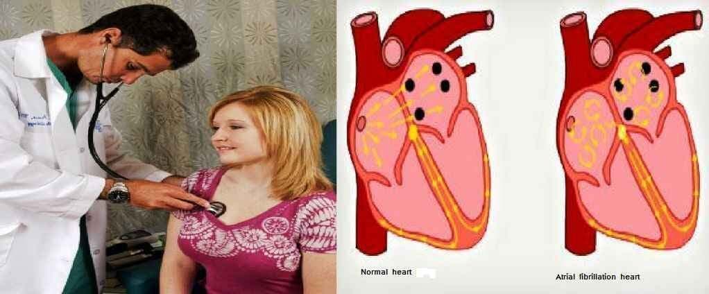 महिलाओं के लिए खतरनाक है ‘धड़कनों का कम या ज्यादा होना’: रिसर्च