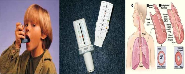 सावधान! बदलता मौसम और बढ़ता प्रदूषण ले सकता है आपकी जान