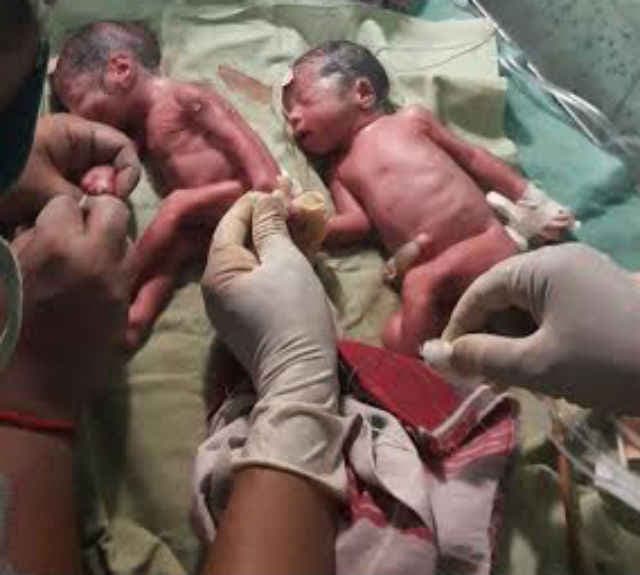 धनबाद : महिला ने चार बच्चों को दिया जन्म