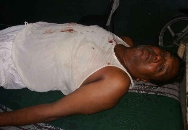 बिहार : साइड नहीं देने पर डॉक्टर के भाई पर जानलेवा हमला