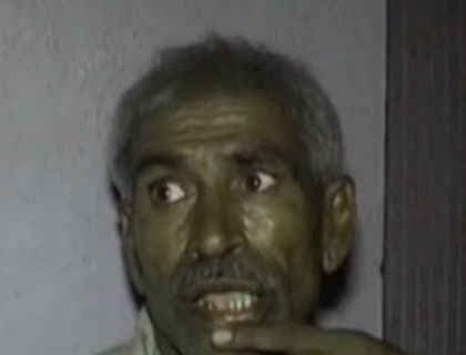 बेटी से दुष्कर्म की शिकायत SSP से की, गुस्साये थानेदार ने पीड़ित के पिता का दांत तोड़ा