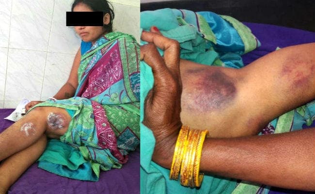 सीतामढ़ी : बैरगनिया में 5000 प्रदर्शनकारियों का उग्र प्रदर्शन, पुलिस ने महिलाओं पर बरसायीं लाठियां, बंद रहीं दुकानें, तस्वीरों में देखें हालात