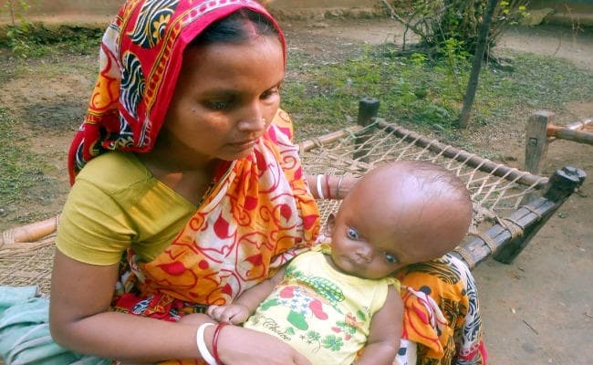 OMG! 8 महीने के बच्चे का सिर इतना बड़ा!