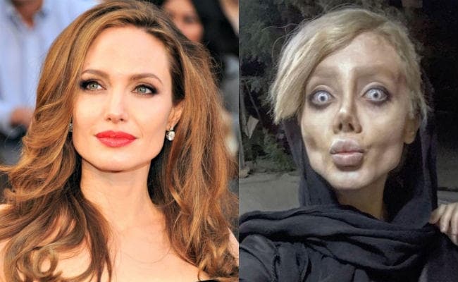 बनना चाहती थीं एंजेलिना जोली, 50 सर्जरी कराने के बाद भी ऐसी दिखने लगी ये लड़की