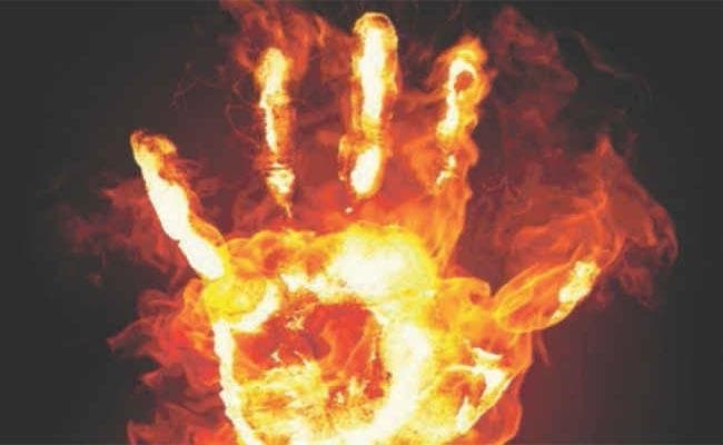 गृहवधू को जलाया, फिर बिना इलाज मार दिया