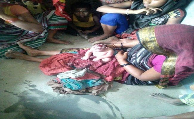 बिहार के कटिहार में जन्मा एलियन जैसा दिखने वाला बच्चा, लोग हैरान