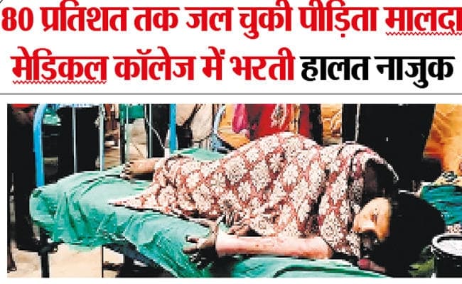 मालदा : संतान नहीं होने पर जलाया