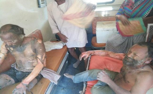 बिहार : आत्मदाह करने वाले दो चीनी मिल कर्मी बुरी तरह झुलसे