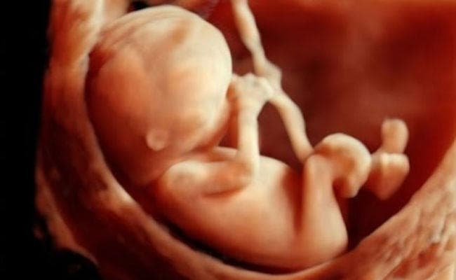 अगर गर्भ में हो बच्चा उलटा तो डिलीवरी में रखें इन बातों का खास ख्याल