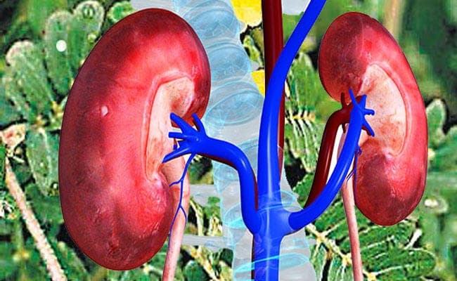 किडनी रोगियों के लिए रामबान औषधि है गोखरू