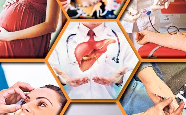 वर्ल्ड हेपेटाइटिस डे : सुरक्षित रहें स्वस्थ रहें
