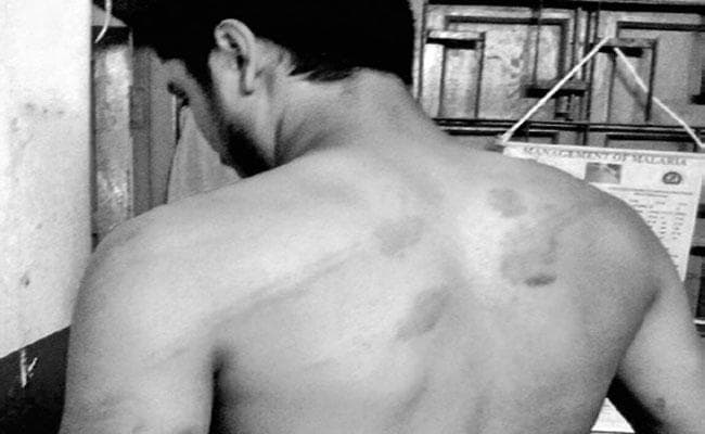बर्बरता: बाइक चोर के संदेह में किया अमानवीय आचरण, फालाकाटा में एसआइ ने दो युवकों पर ढाया जुल्म