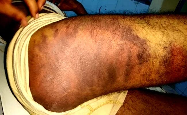 सहरसा : पुलिस की बर्बरता उजागर, पूछताछ के लिए थाने लाकर दी ''थर्ड डिग्री'', देखें वीडियो