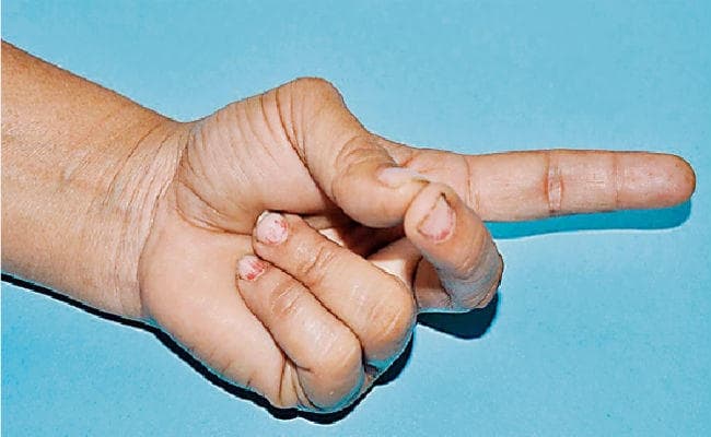 अगर आपको है सांस संबंधी रोग है तो करें ये मुद्रासन, होगा लाभ