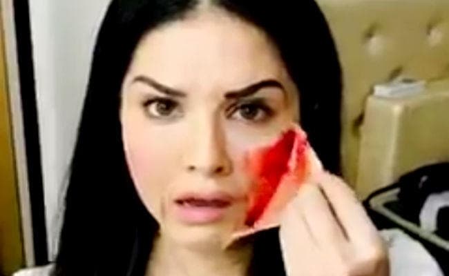 देखें सनी लियोनी को कैसे लगी चोट, पोस्ट किया डरावना VIDEO