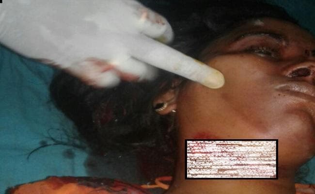 ससुराल पहुंच नशेड़ी पति ने पत्नी का गला रेत, स्थिति नाजुक