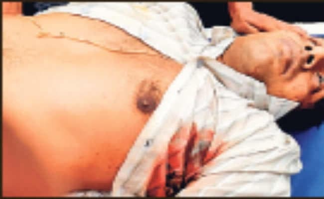 टीटागढ़ : तृणमूल कांग्रेस कार्यकर्ता को मारी गोली, हालात गंभीर, कोलकाता के निजी अस्पताल में भर्ती