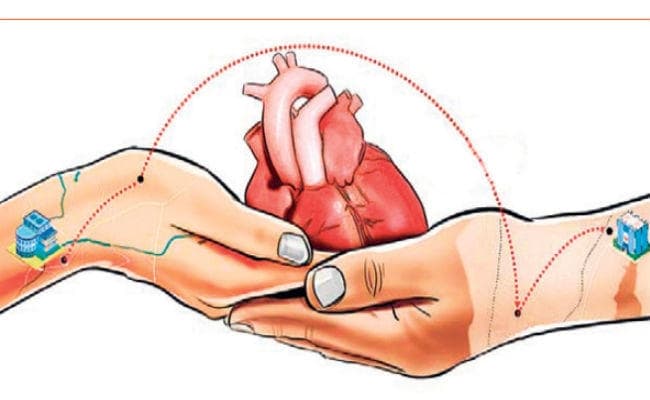 कोलकाता : पहली बार सरकारी अस्पताल में हृदय प्रत्यारोपण