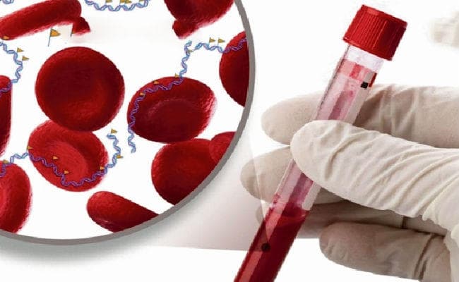 ब्लड टेस्ट से 10 मिनट में लग जायेगा हर तरह के कैंसर का पता