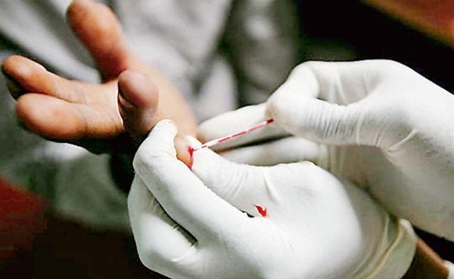HIV मरीजों के लिए आया नया कैप्सूल