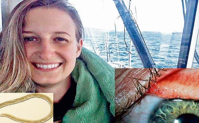 .....जब यूएस में महिला की आंख से निकाले गये 14 कीड़े