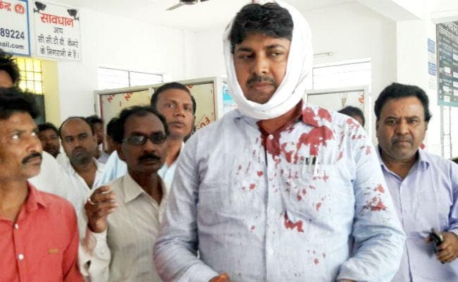 #VIDEO : प्रमुख के चेंबर में कुर्सी से बीडीओ का सिर फोड़ा, प्रमुख भी हुईं घायल, बीडीओ ने कहा- साजिशन किया गया हमला