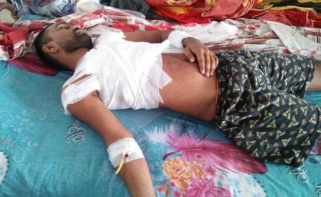 बिहार : भभुआ जेल में कैदी ने ब्लेड से सीने को किया जख्मी, 80 टांके लगे