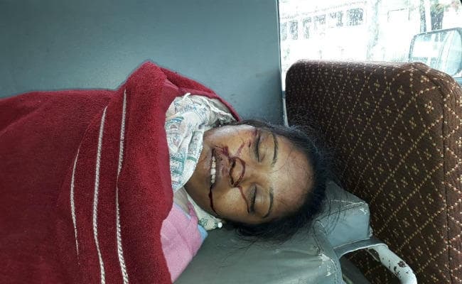 सिमडेगा : सड़क दुर्घटना में पिता-पुत्री की मौत, एक घायल