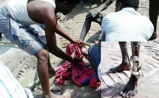 डंसने के बाद भी पैर से लिपटा रहा सांप, जानिये उसके बाद क्या हुआ