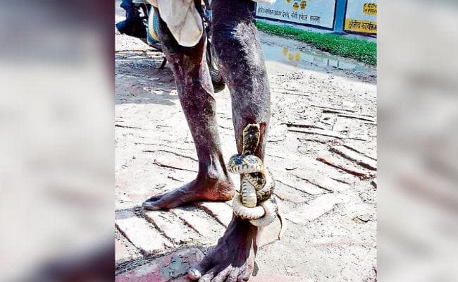 मधेपुरा : ...जब डसने के बाद भी पैर से लिपटा रहा सांप, अस्पताल में चिकित्सकों और ग्रामीणों ने छुड़वाया