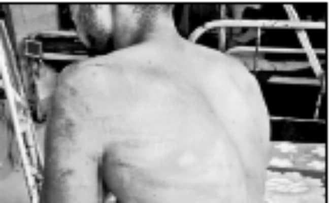 दिनहाटा तृणमूल में फिर भड़का गुटीय संघर्ष, दोनों पक्षों से दो कार्यकर्ता घायल, अस्पताल में भर्ती