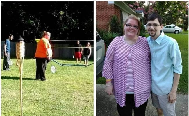 महिला के पेट से निकाला 22.50 किलो का ट्यूमर