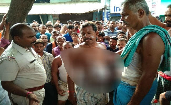बिहार : दुकान के बाहर सोये दुकानदार पर अपराधियों ने फेंका तेजाब, आगजनी